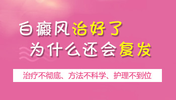 颈部白癜风扩散要怎么治